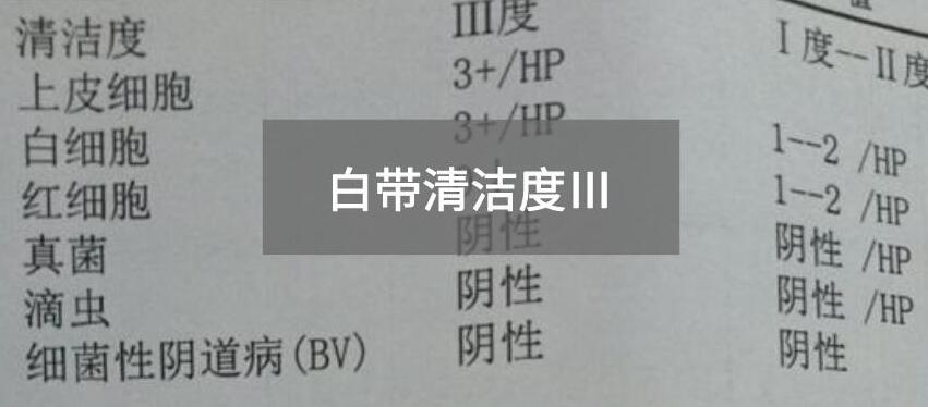 今天快讯！全自动白带麻豆高清黄色视频生产厂家麻豆电影在线观看为您官方解释白带清洁度3的意思