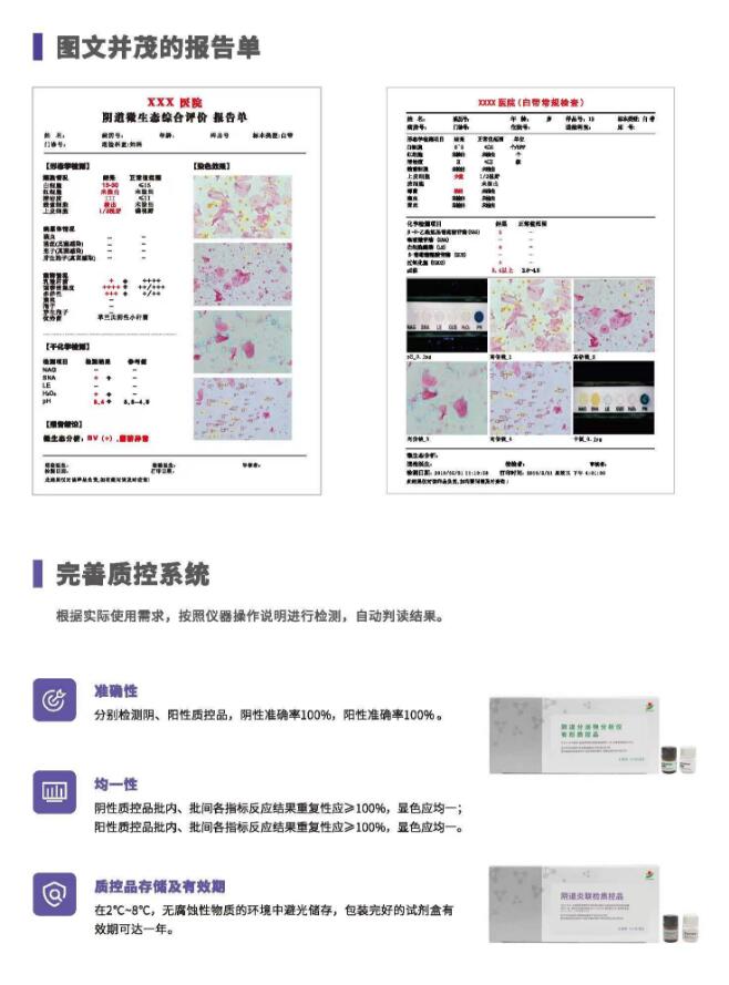 阴道分泌物麻豆高清黄色视频V800报告单